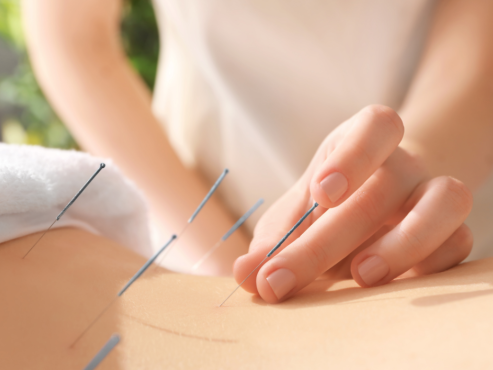 Calm acupuncture treatment room in Chiswick, W4